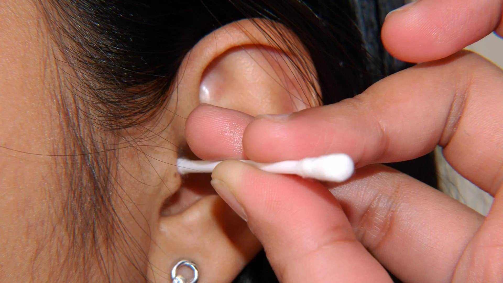 Что нужно знать о дрожжевой инфекции в ушах