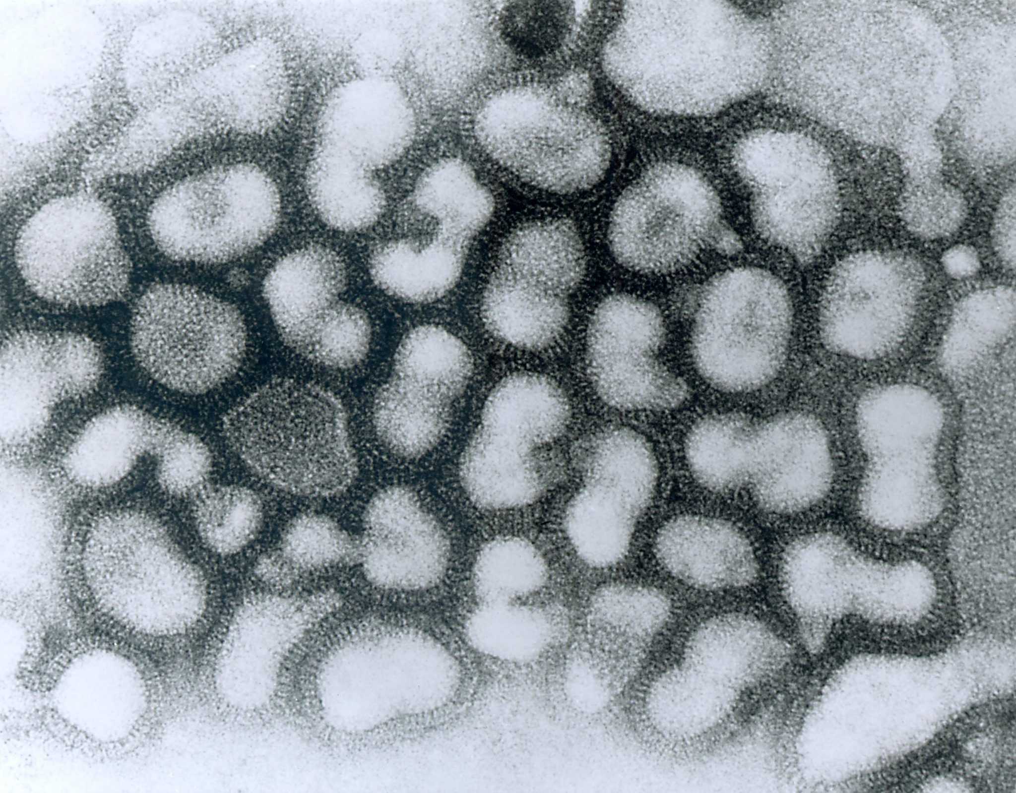 Есть ли повод для беспокойства по поводу нового «самого смертельного» (H7N9) штамма птичьего гриппа?