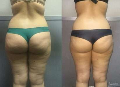 3 существенные подсказки по сжиганию жира для женщин