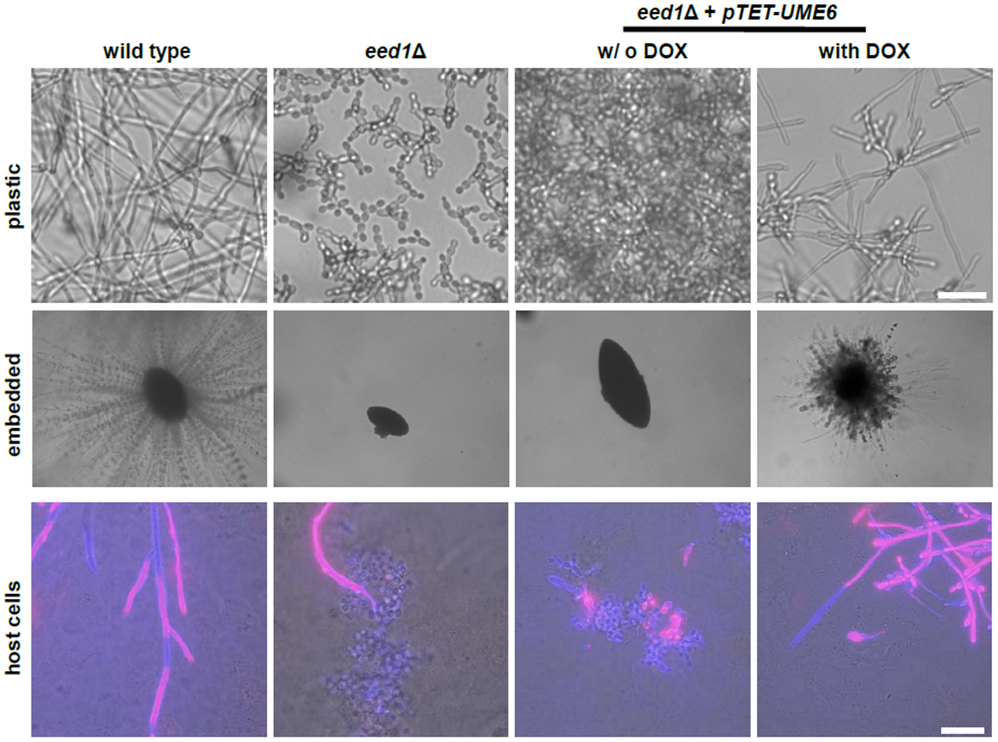 Простое, самое быстрое домашнее лечение молочницы